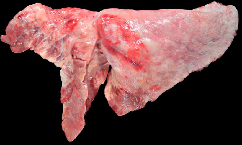 Figure 5: Pig lung co-infected with&nbsp;M. hyopneumoniae and&nbsp;A. pleuropneumoniae.&nbsp; Cranioventral areas of consolidation with a reddish-brown color, caused by infection by&nbsp;M. hyopneumoniae, and an oval-shaped lesion with pleural fibrosis and hemorrhagic area in the&nbsp;diaphragmatic lobe, which would correspond to the chronical stage after&nbsp;an outbreak of necrosis caused by&nbsp;A. pleuropneumoniae.
